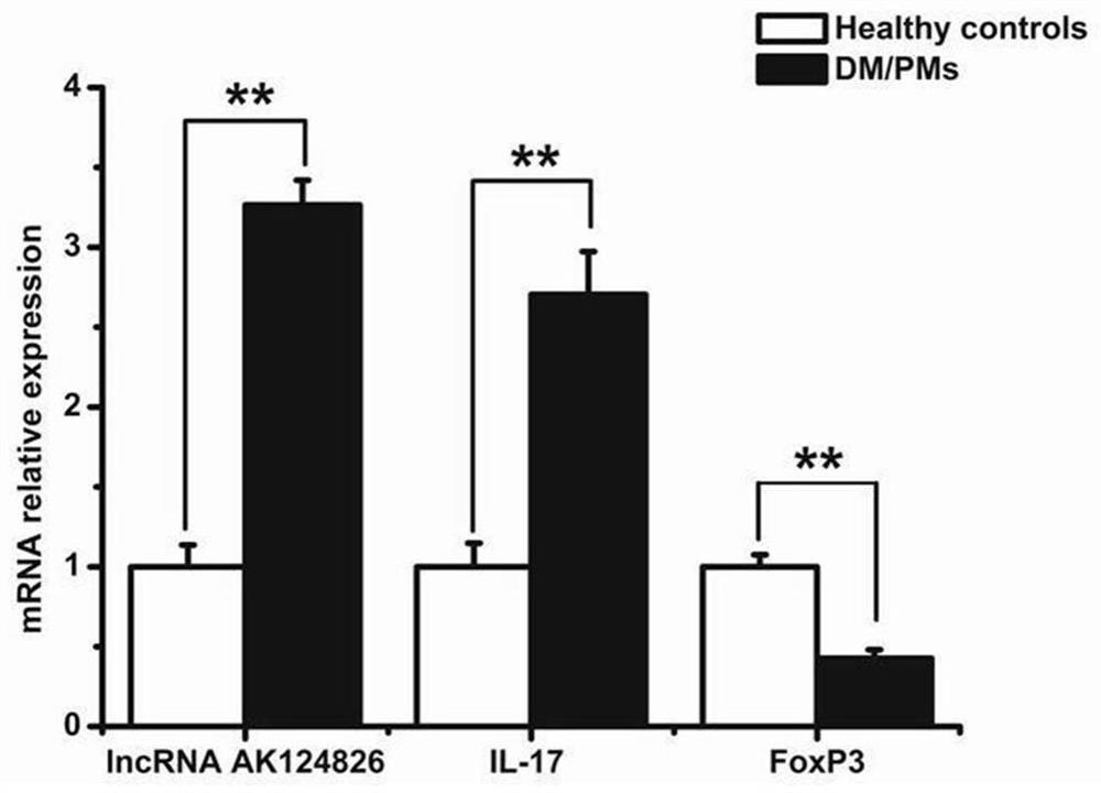 Application of lncRNA AK124826 and related molecules thereof in diagnosis of polymyositis/dermatomyositis