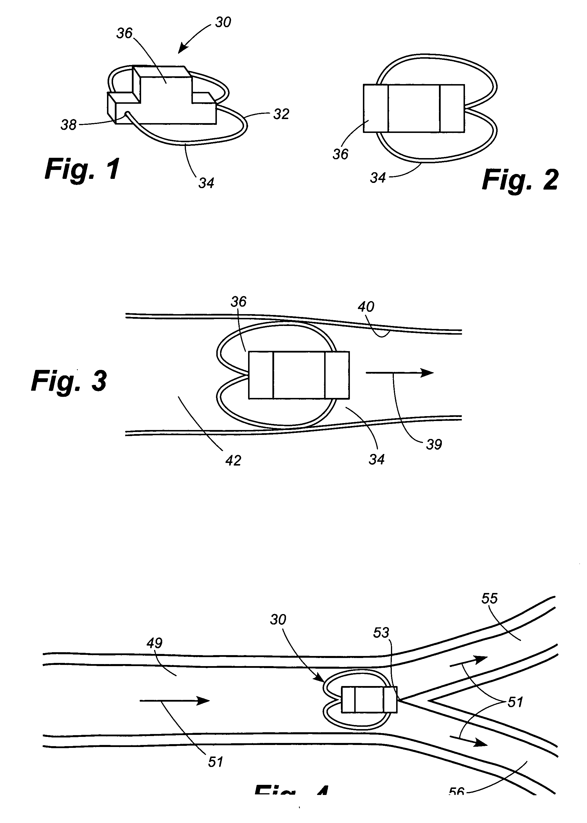 Apparatus and method for sensor deployment and fixation
