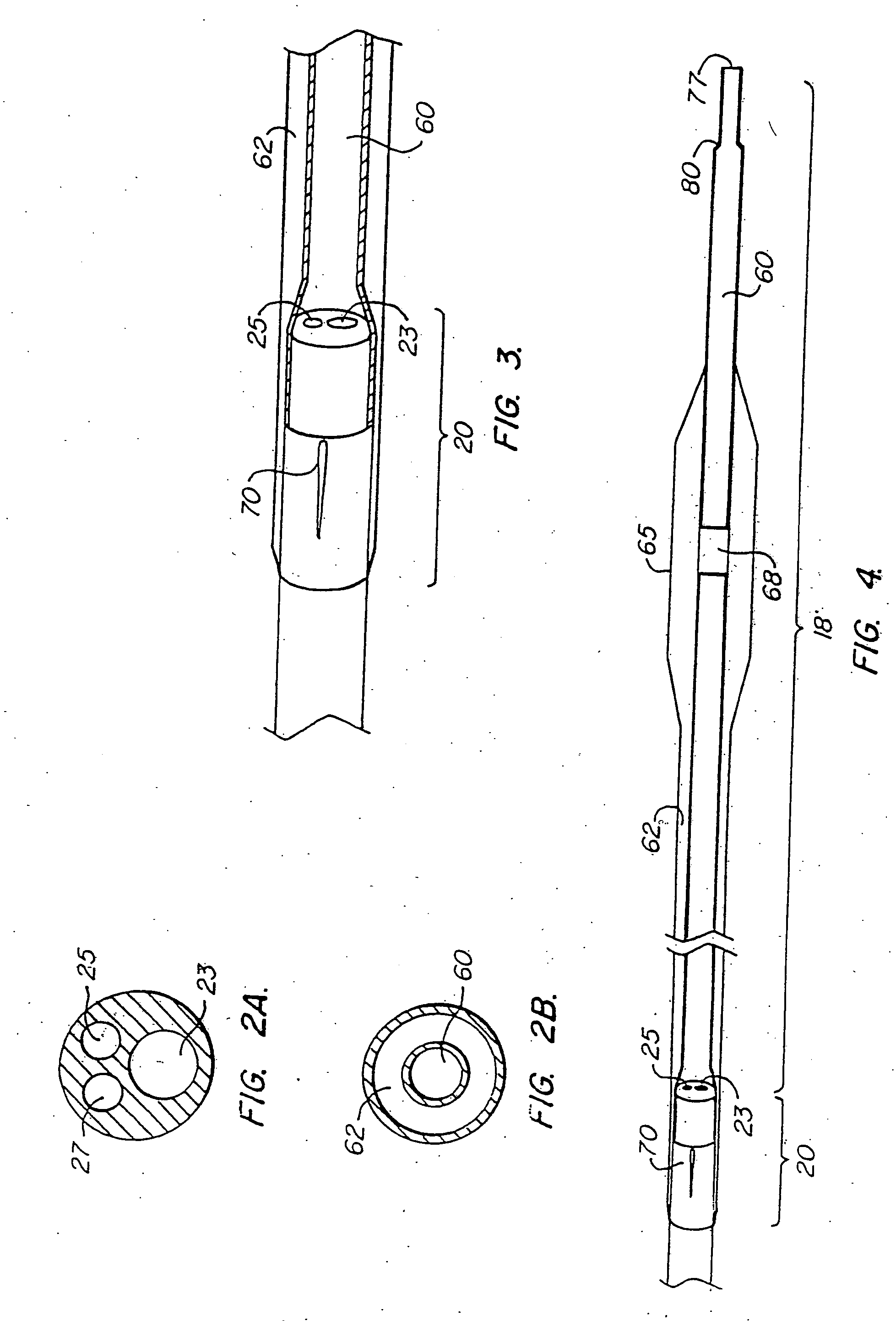 Catheter system having a balloon angioplasty device disposed over a work element lumen