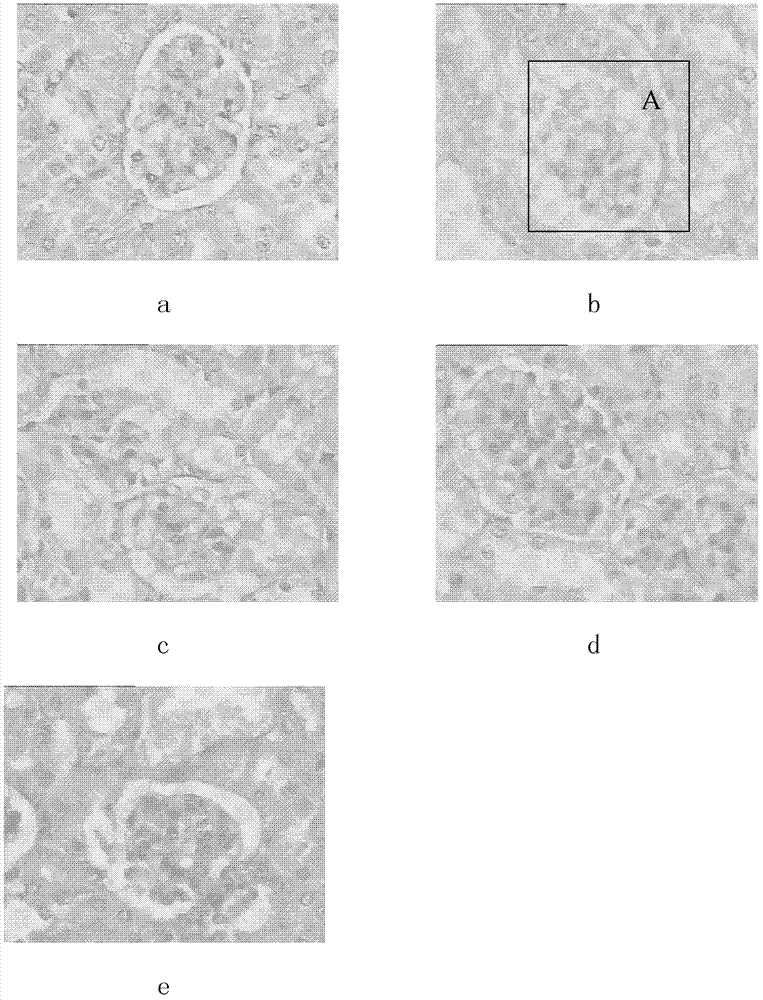 Composite aqueous extract of Fu brick tea and application thereof