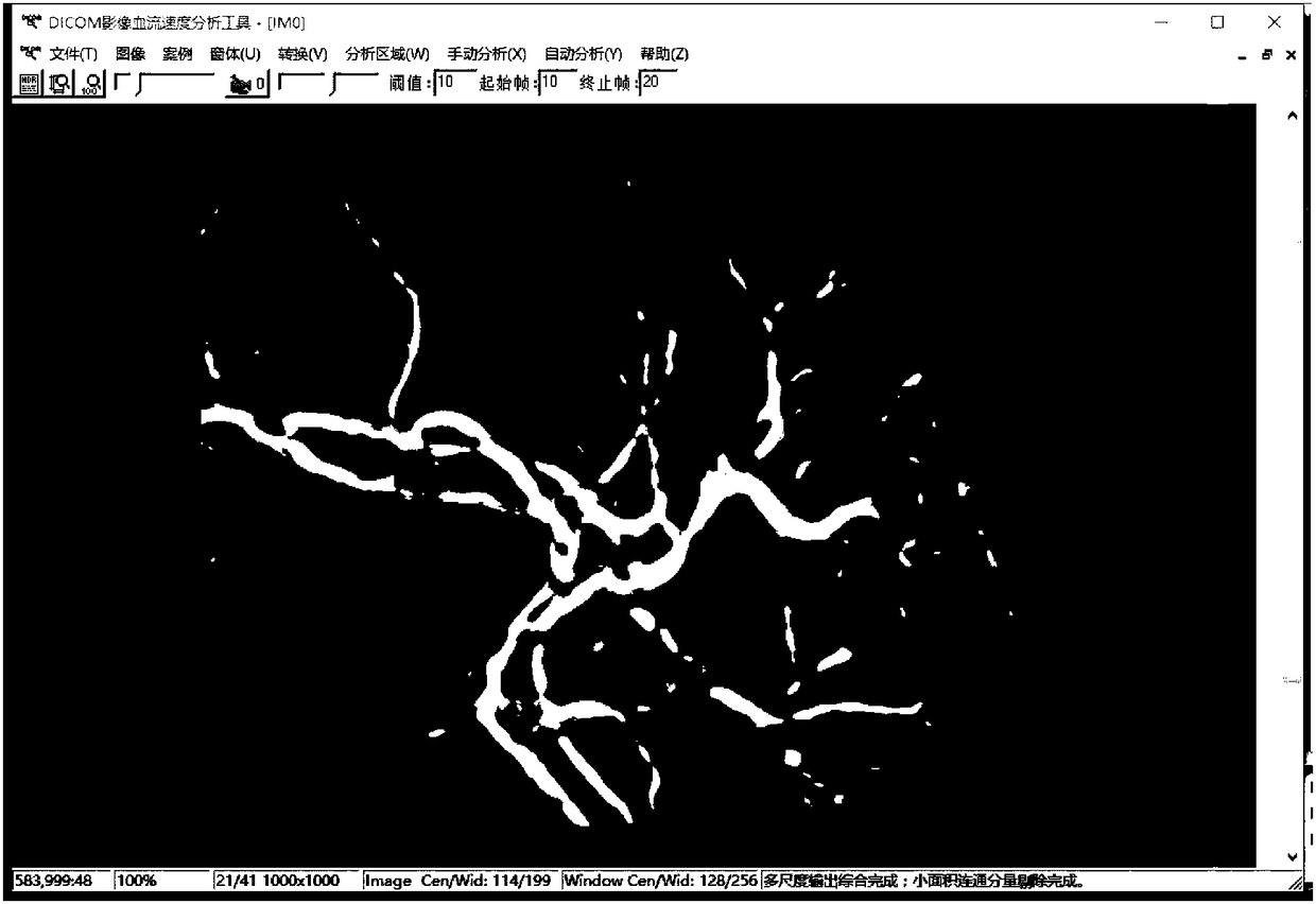 A dicom image blood flow analysis system