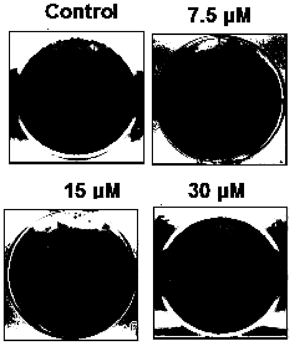 Application of stigmasterol to preparing gastric cancer treating drugs