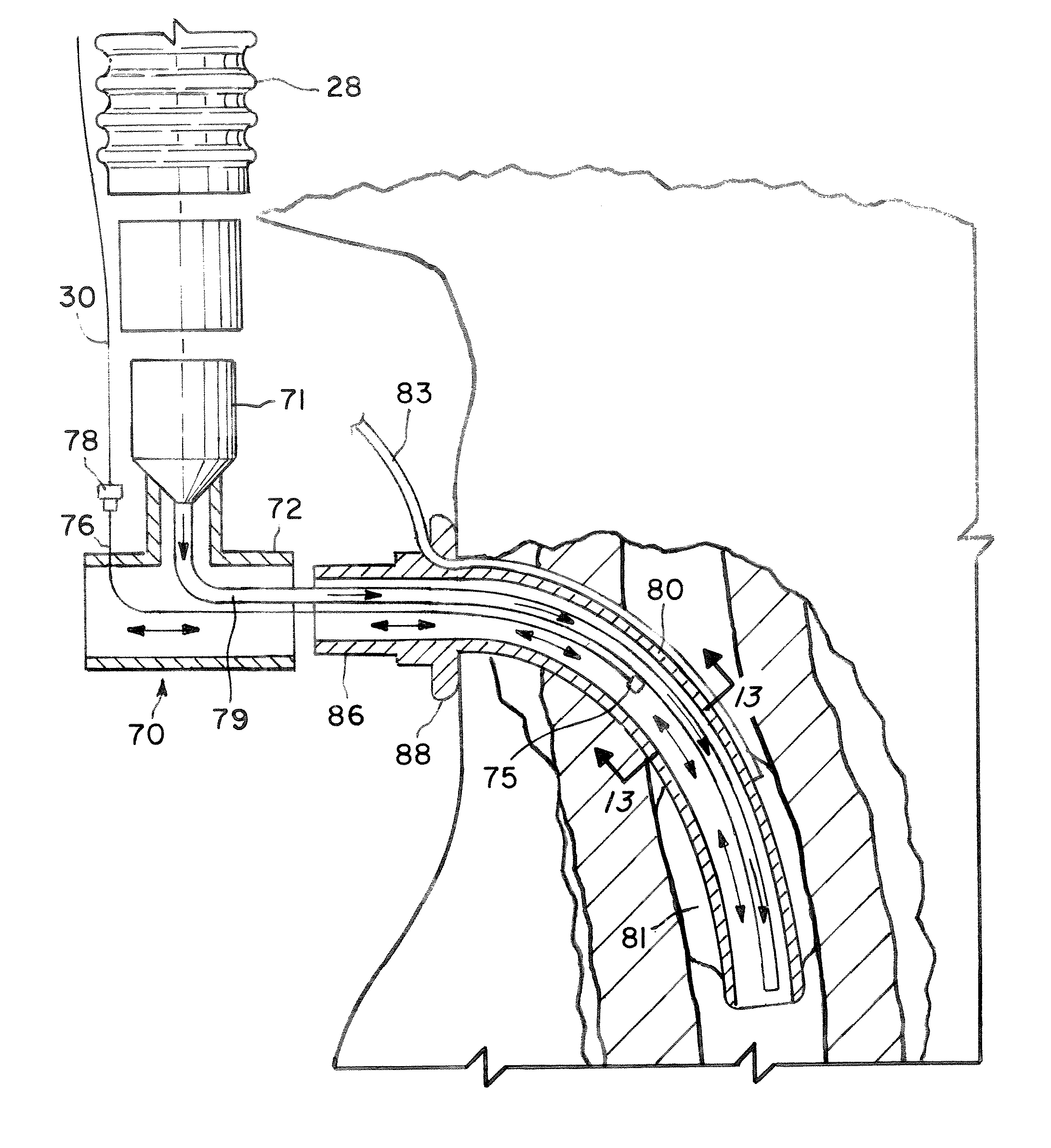 System for providing flow-targeted ventilation synchronized to a patients breathing cycle