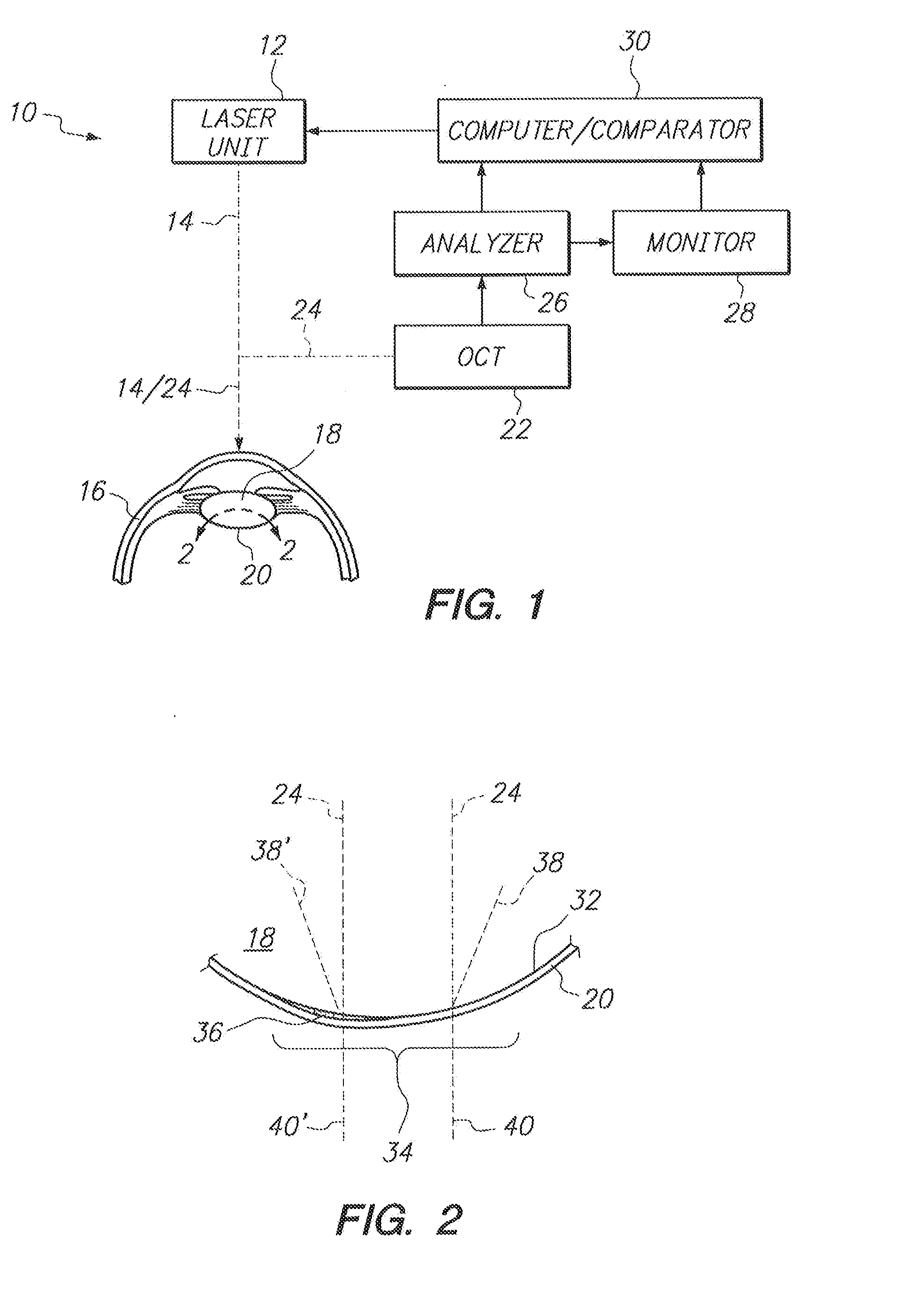 System and Method for Obviating Posterior Capsule Opacification