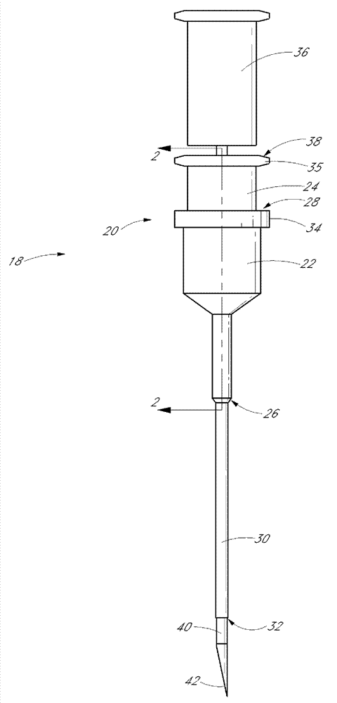 Catheter aseembly blood control device and related methods