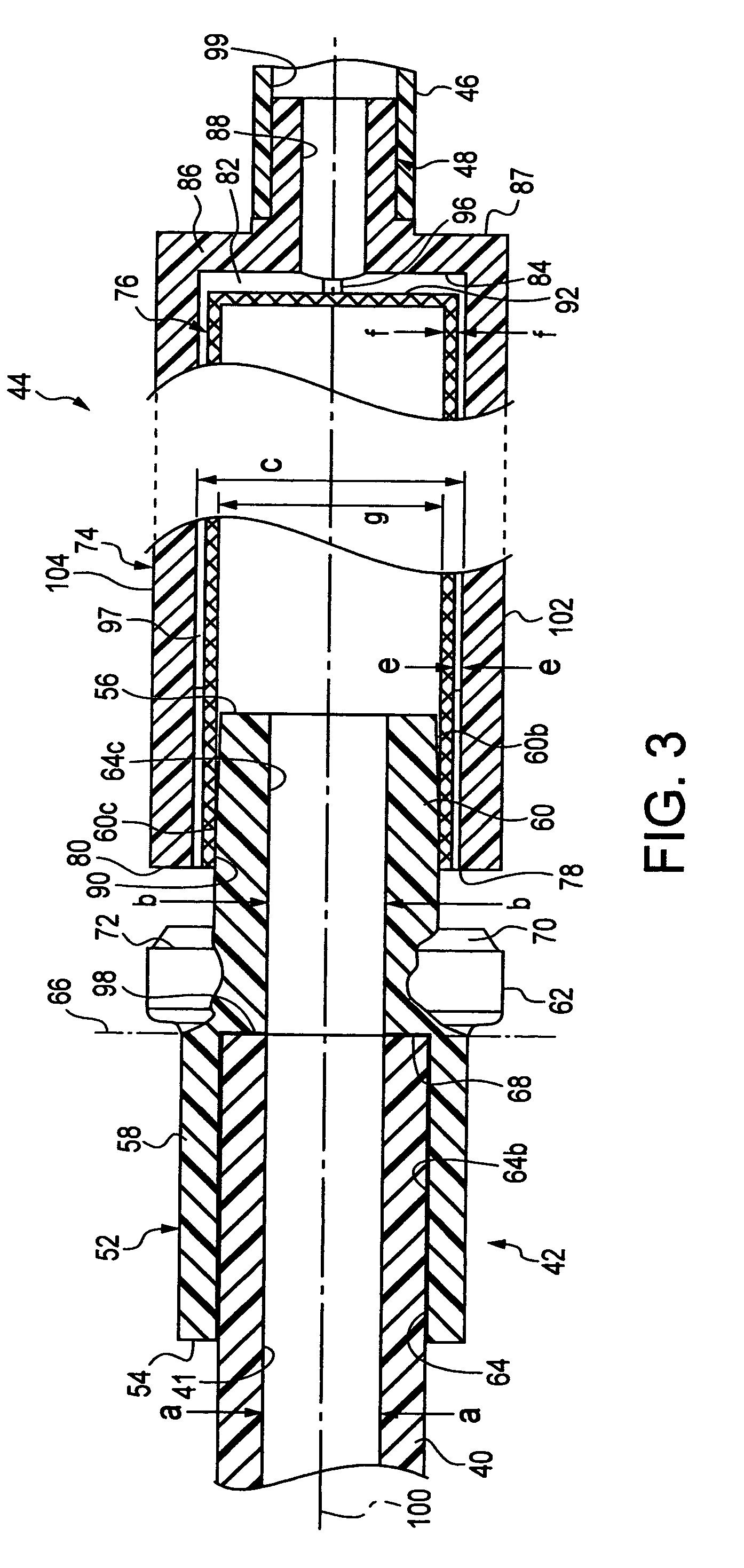 Surgical apparatus and methods asociated therewith