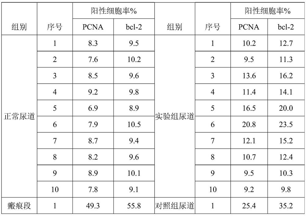 Stent and application thereof