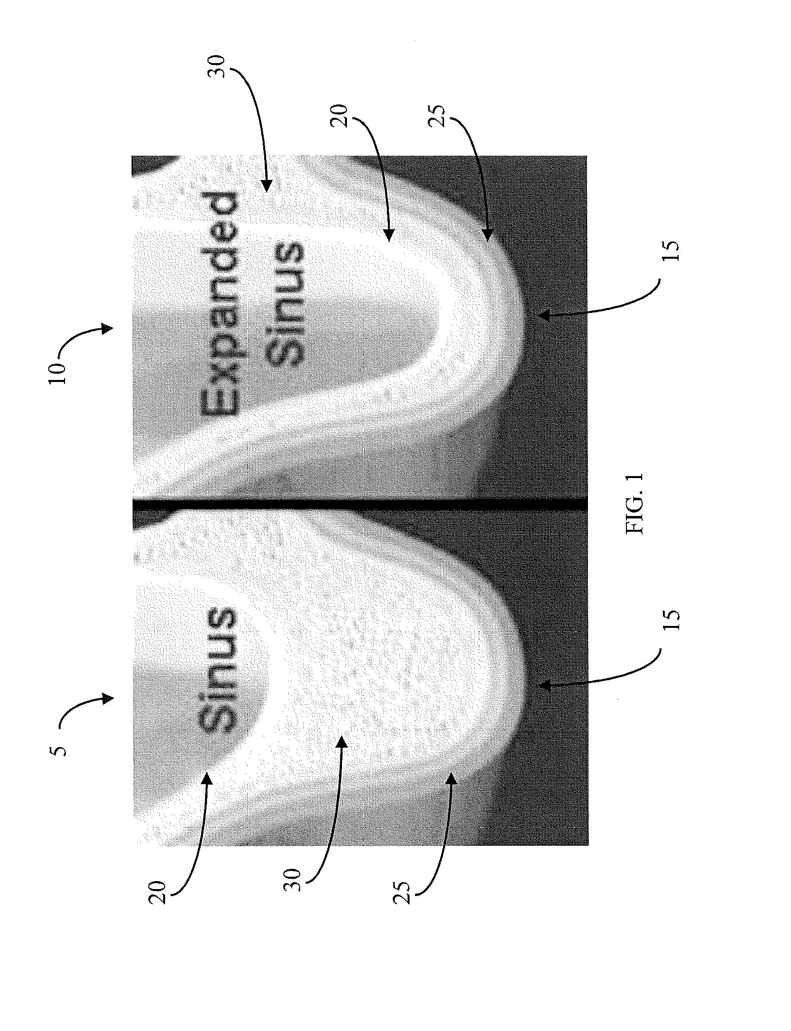 Method for conducting a guided sinus lift procedure