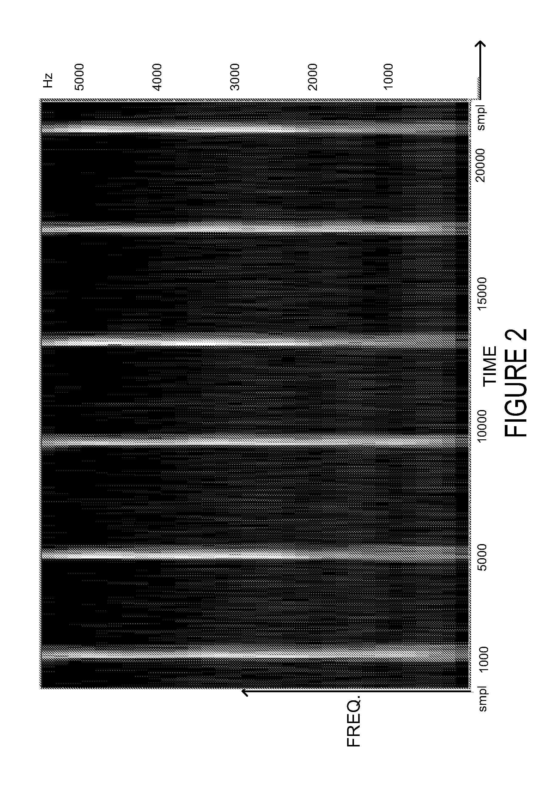 Repetitive Transient Noise Removal