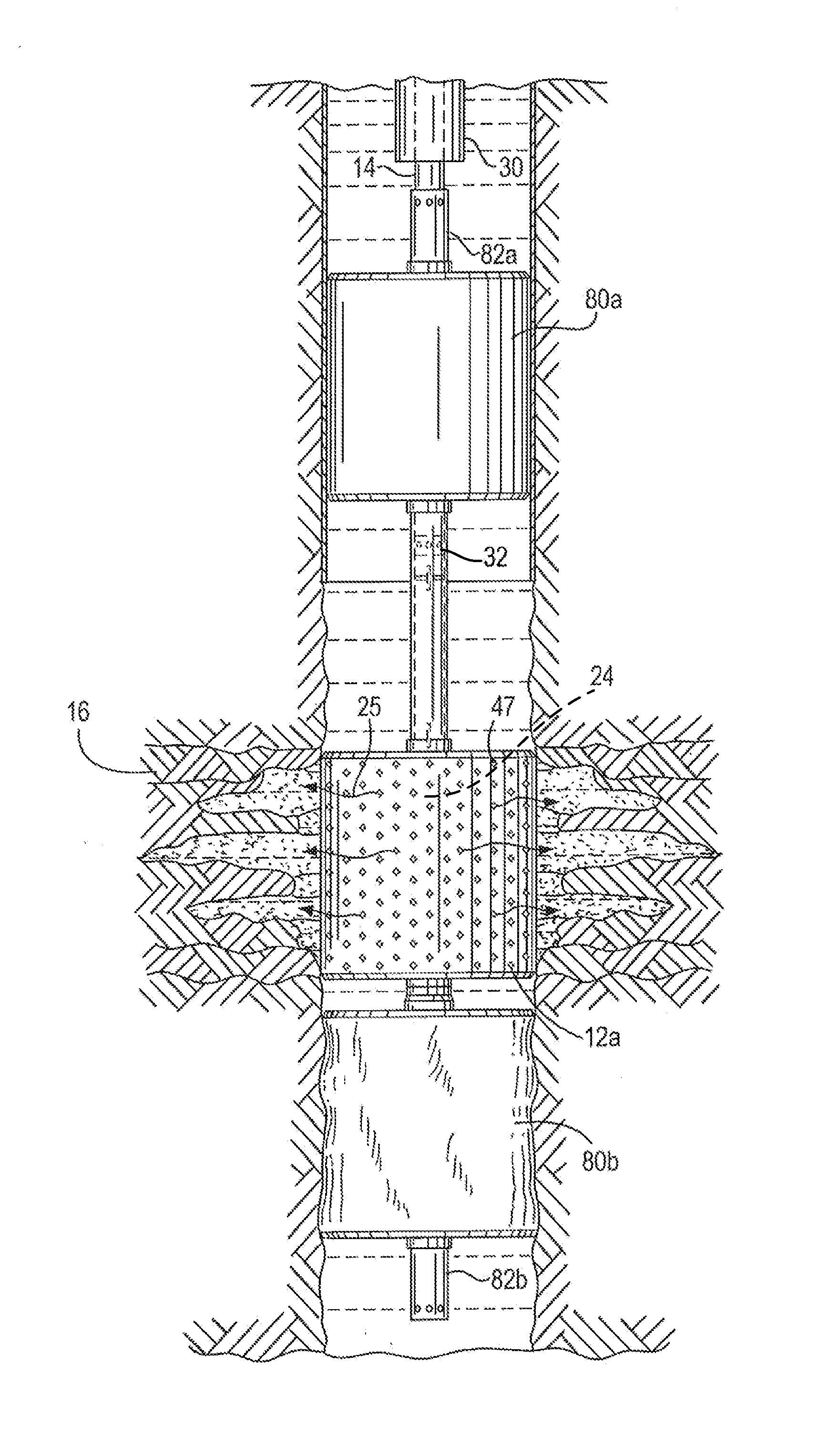 Method and apparatus for sealing an undesirable formation zone in the wall of a wellbore