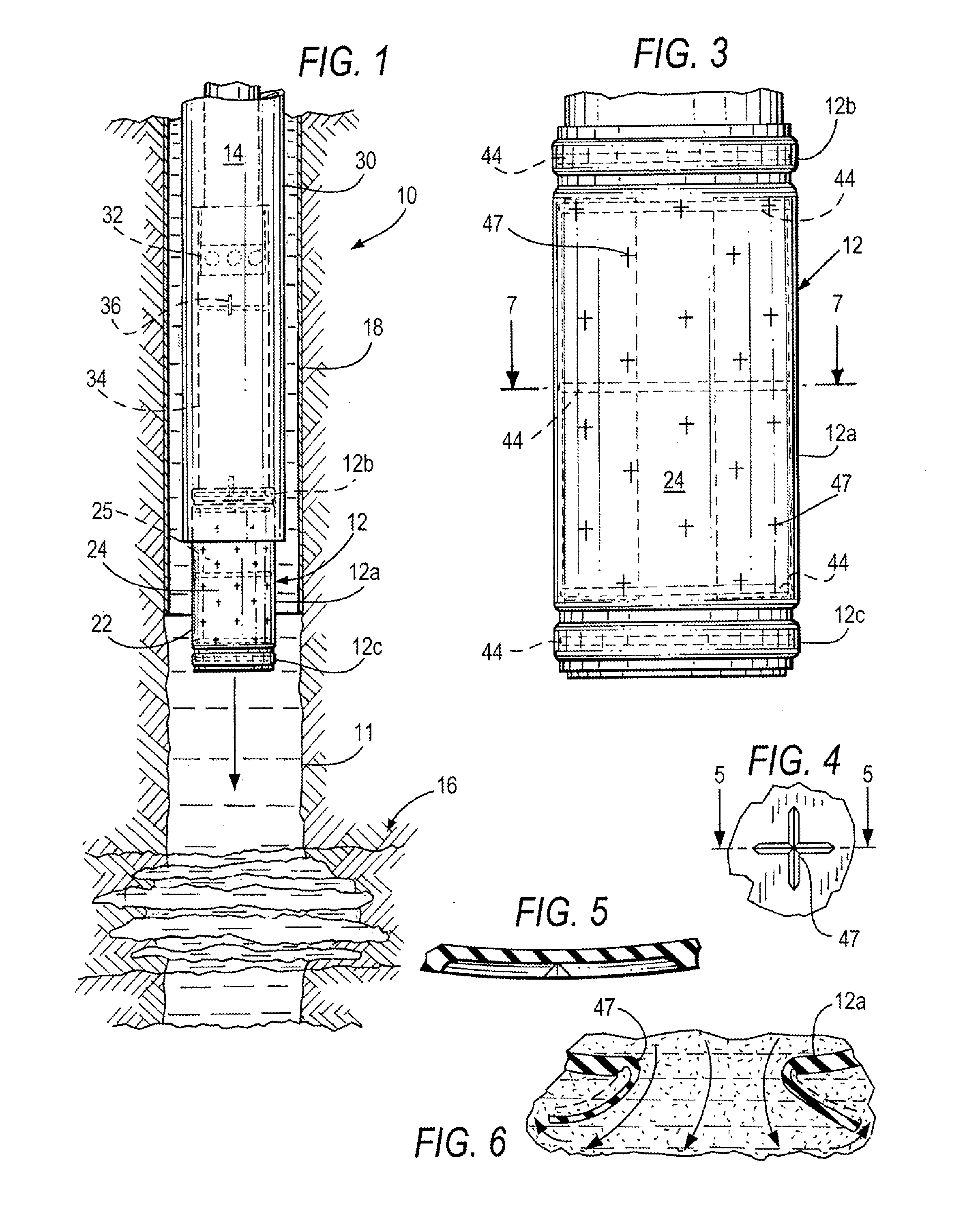 Method and apparatus for sealing an undesirable formation zone in the wall of a wellbore
