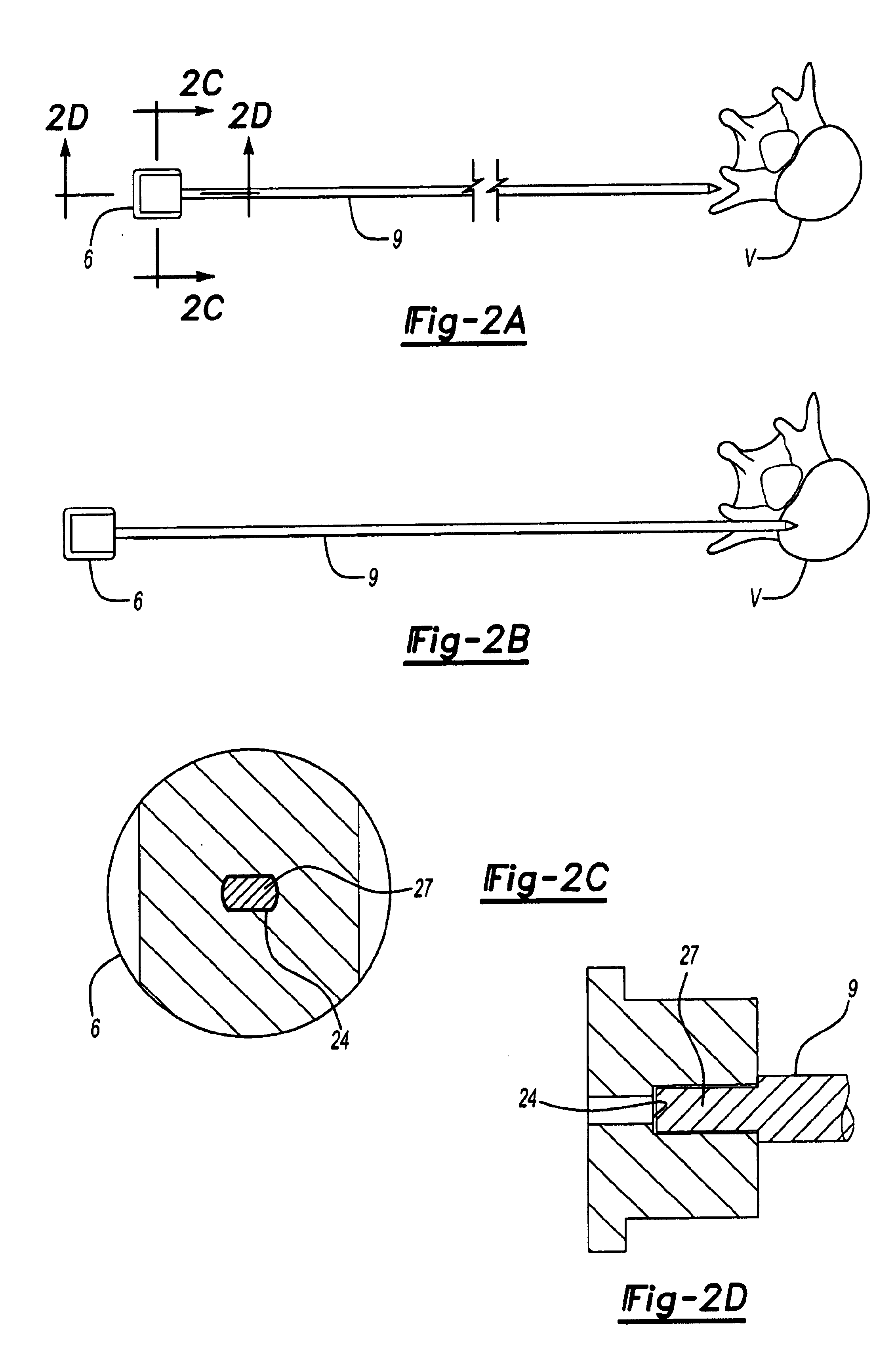Biopsy/access tool with integrated biopsy device and access cannula and use thereof