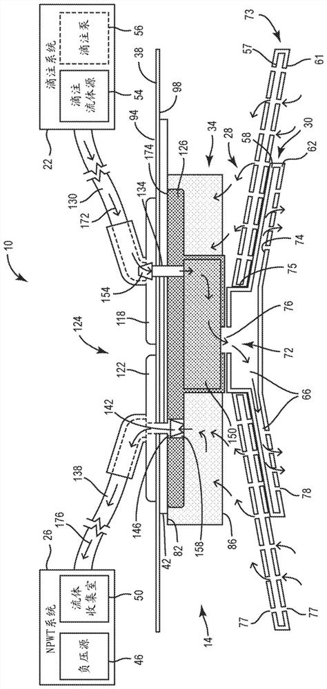 Systems and methods for managing pneumatic pathways in integrated multilayer wound dressings