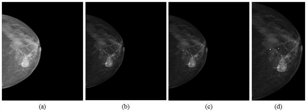A Semantic Segmentation Method for Masses in Mammography Images Based on Deep Residual Networks