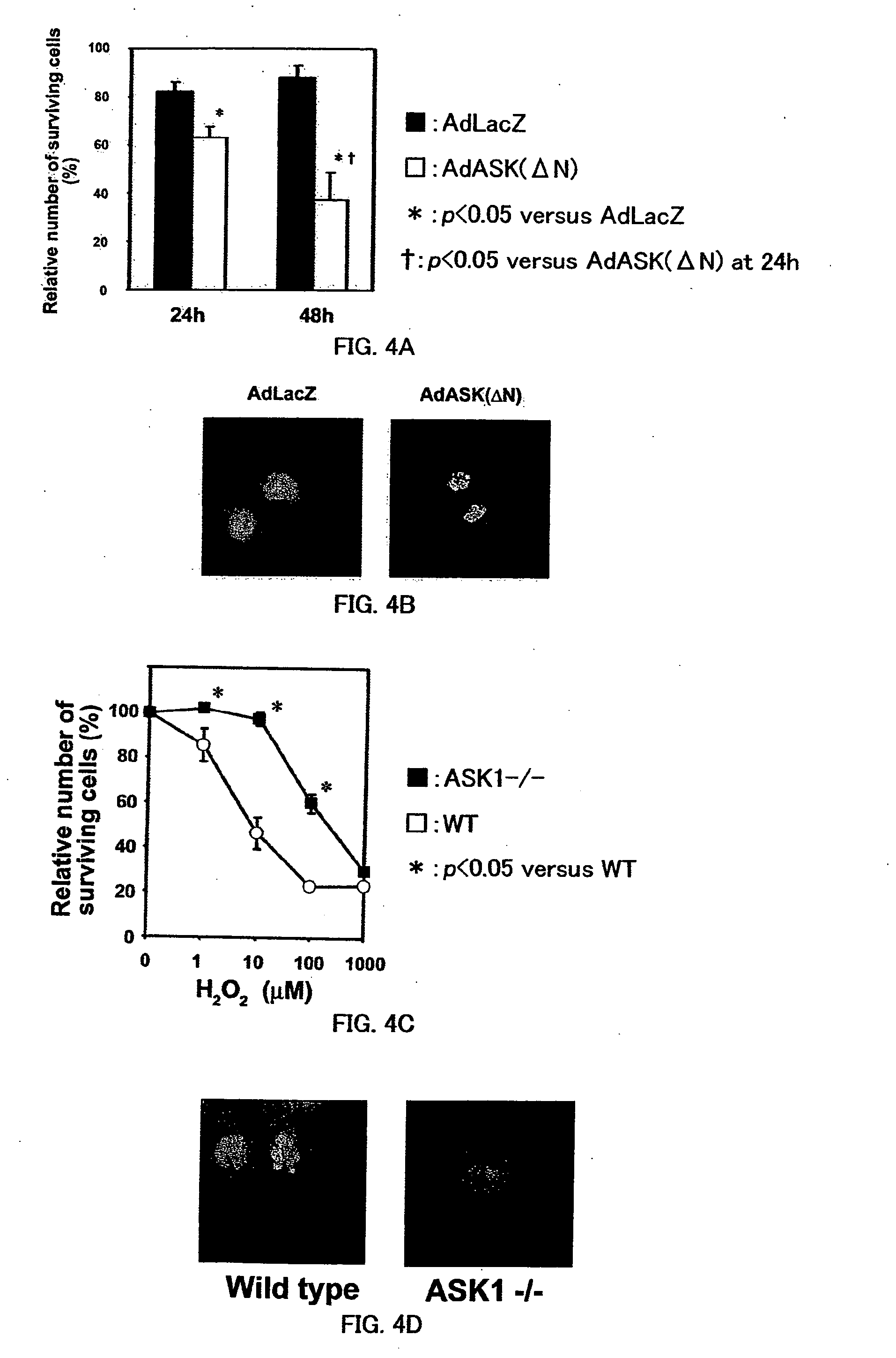 Remedy for cardiac failure containing ask1 inhibitor as active ingredient and method for screening the same