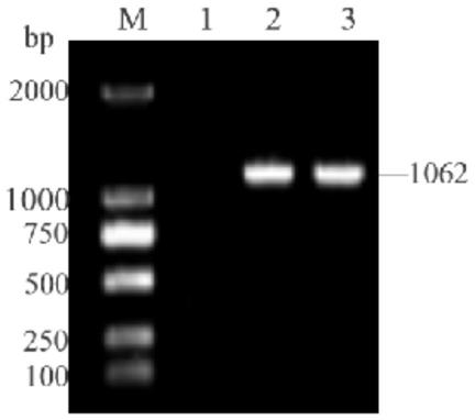 Construction and application of recombinant lactobacillus paracasei displaying porcine rotavirus VP7 protein on surfaces