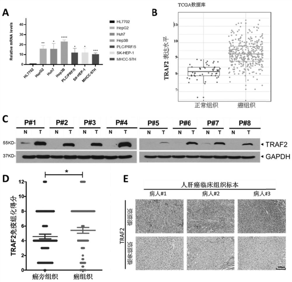 Marker for diagnosing liver cancer, and detection reagent and application of marker