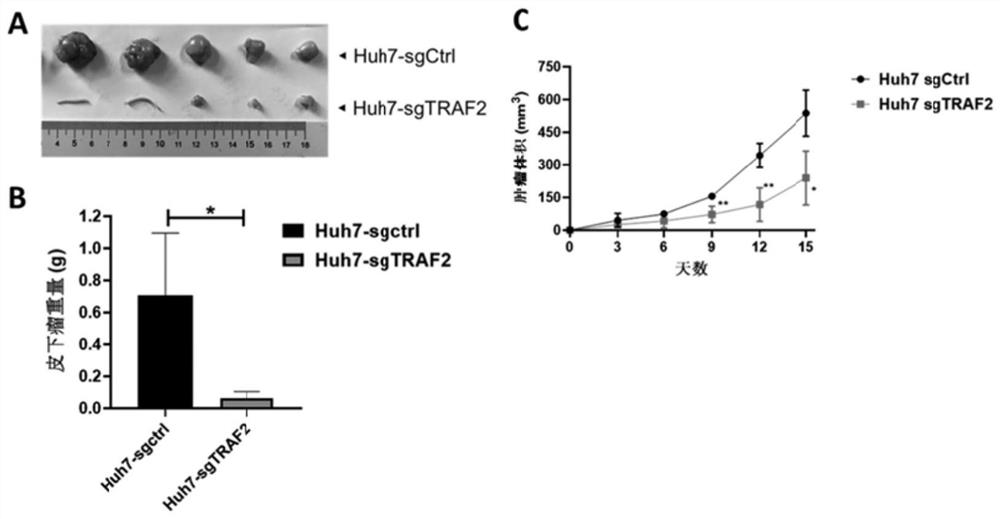 Marker for diagnosing liver cancer, and detection reagent and application of marker