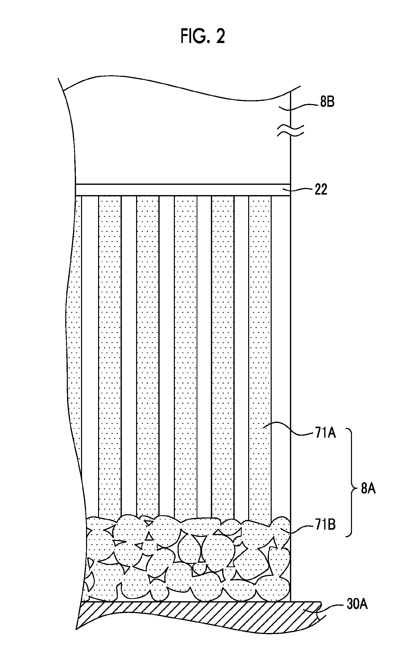 Radiation detector and radiological image radiographing apparatus
