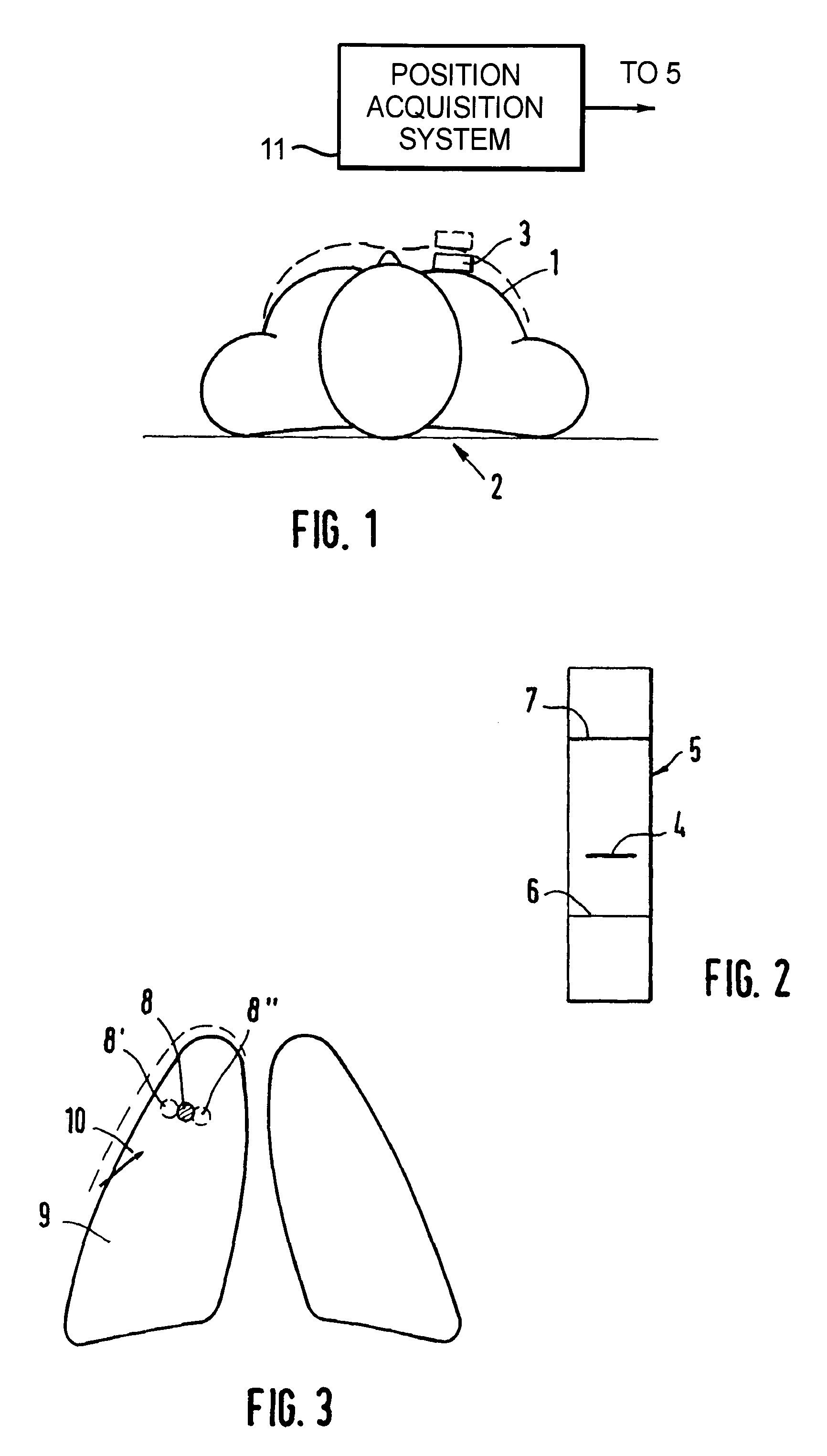 Method for respiration-dependent triggering of a medical image exposure