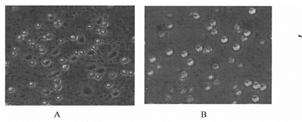 Preparation method of DCs, and application of DCs in preparing anti-tumor cell preparation