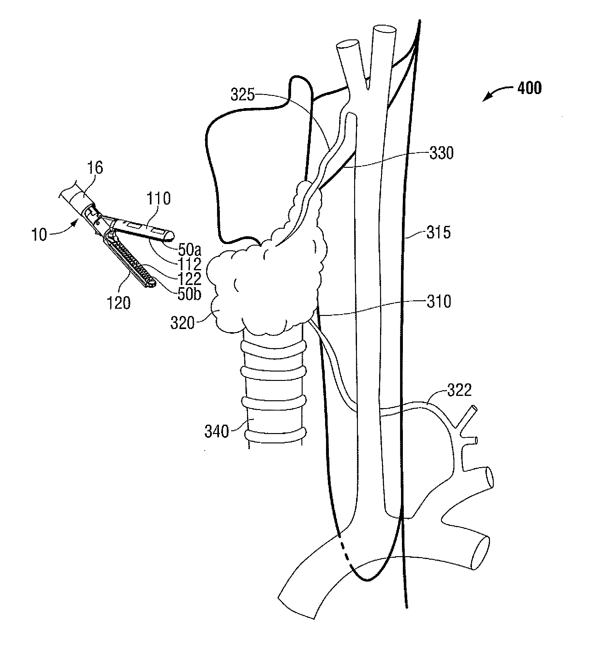 System and Method for Determining Proximity Relative to a Nerve