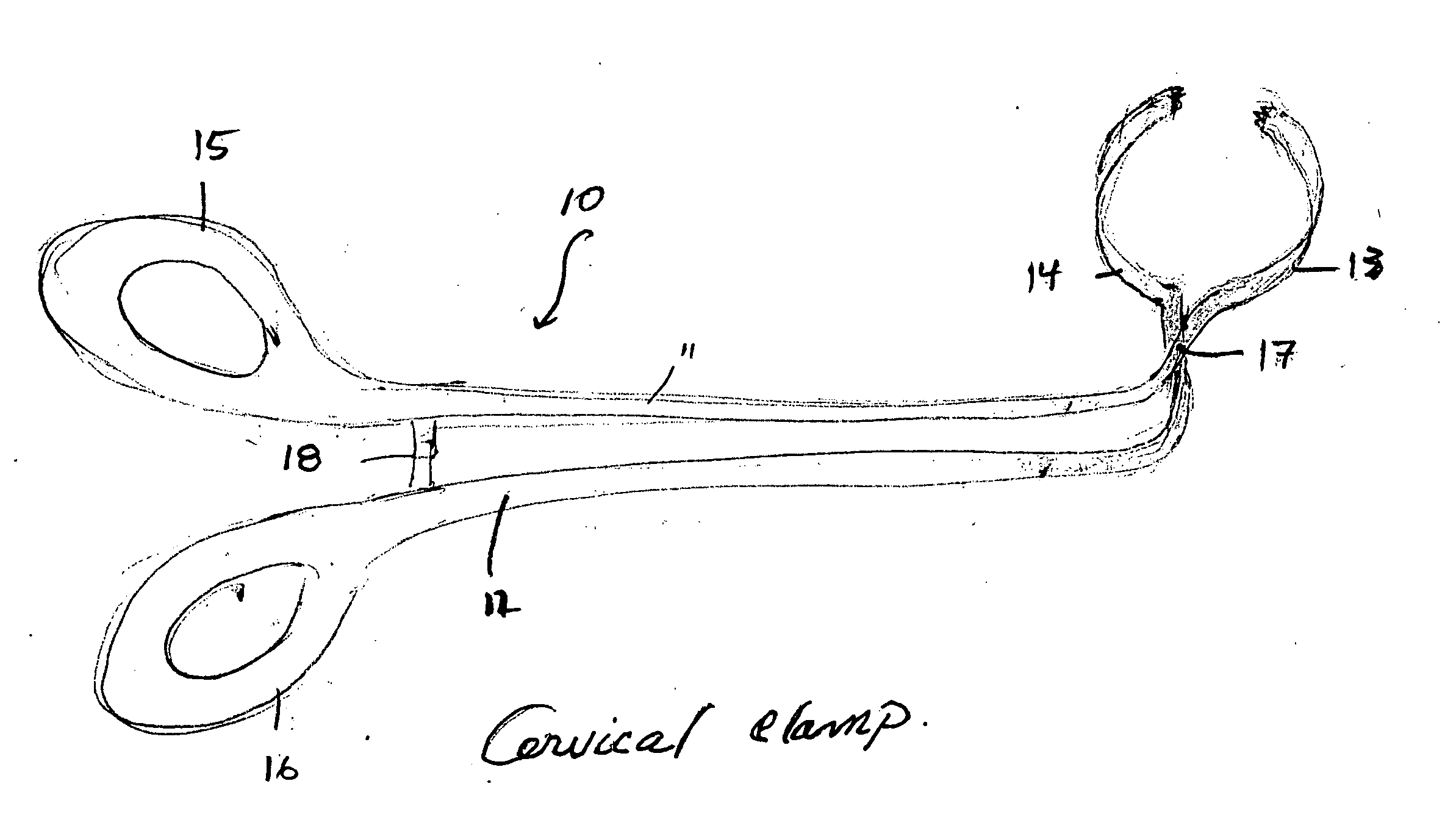 Device for sealing a cervical canal