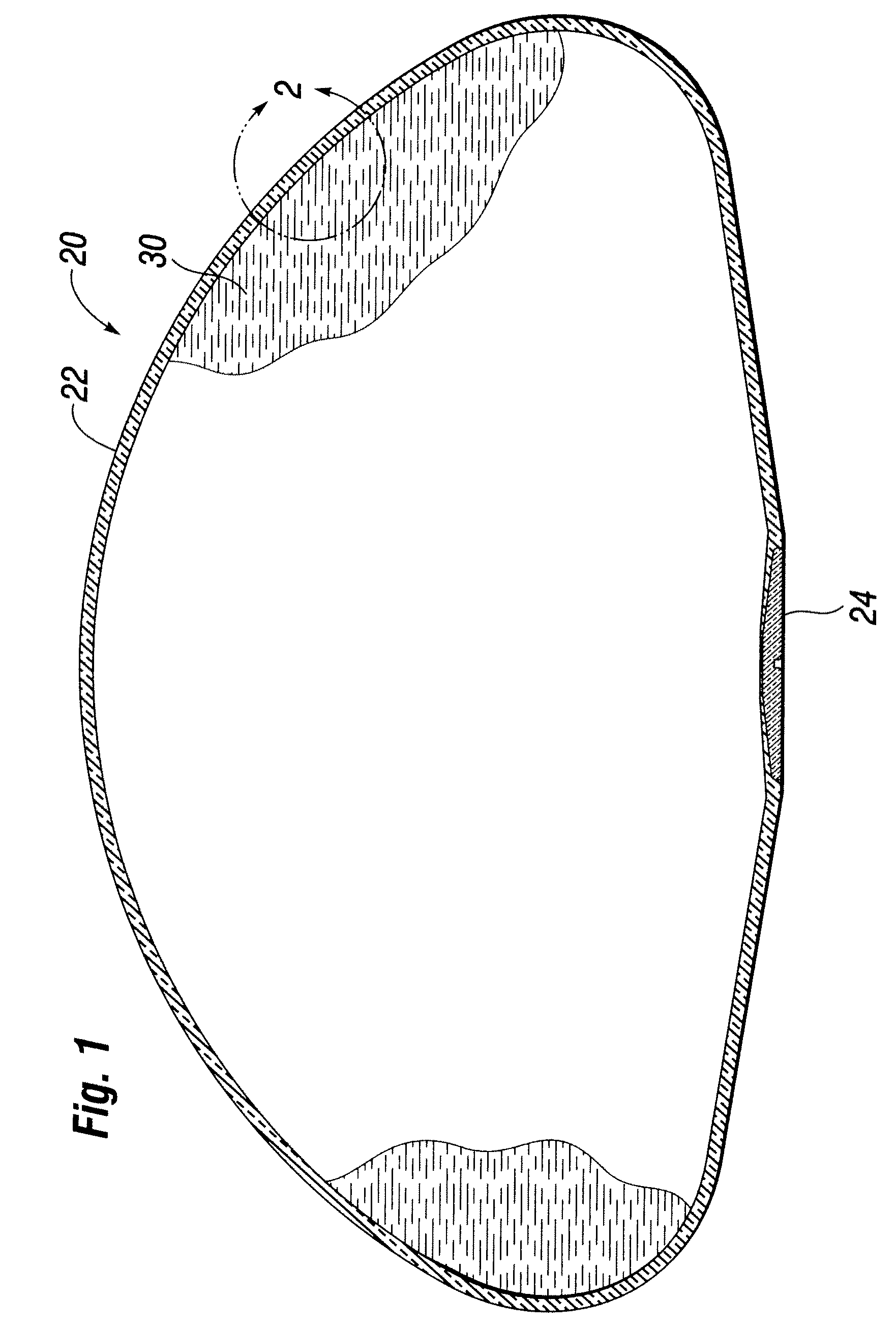 Self-sealing shell for inflatable prostheses