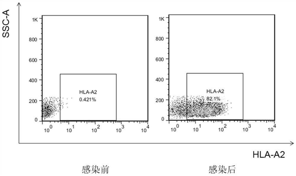 Multi-MHC genotype and antigen MiniGene combinatorial library as well as construction method and application thereof