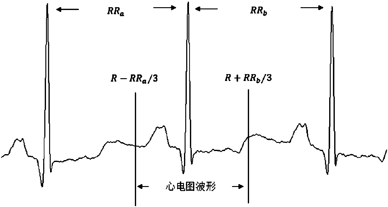 Method and system for performing real-time cardiac monitoring by using wearable electrocardiogram device