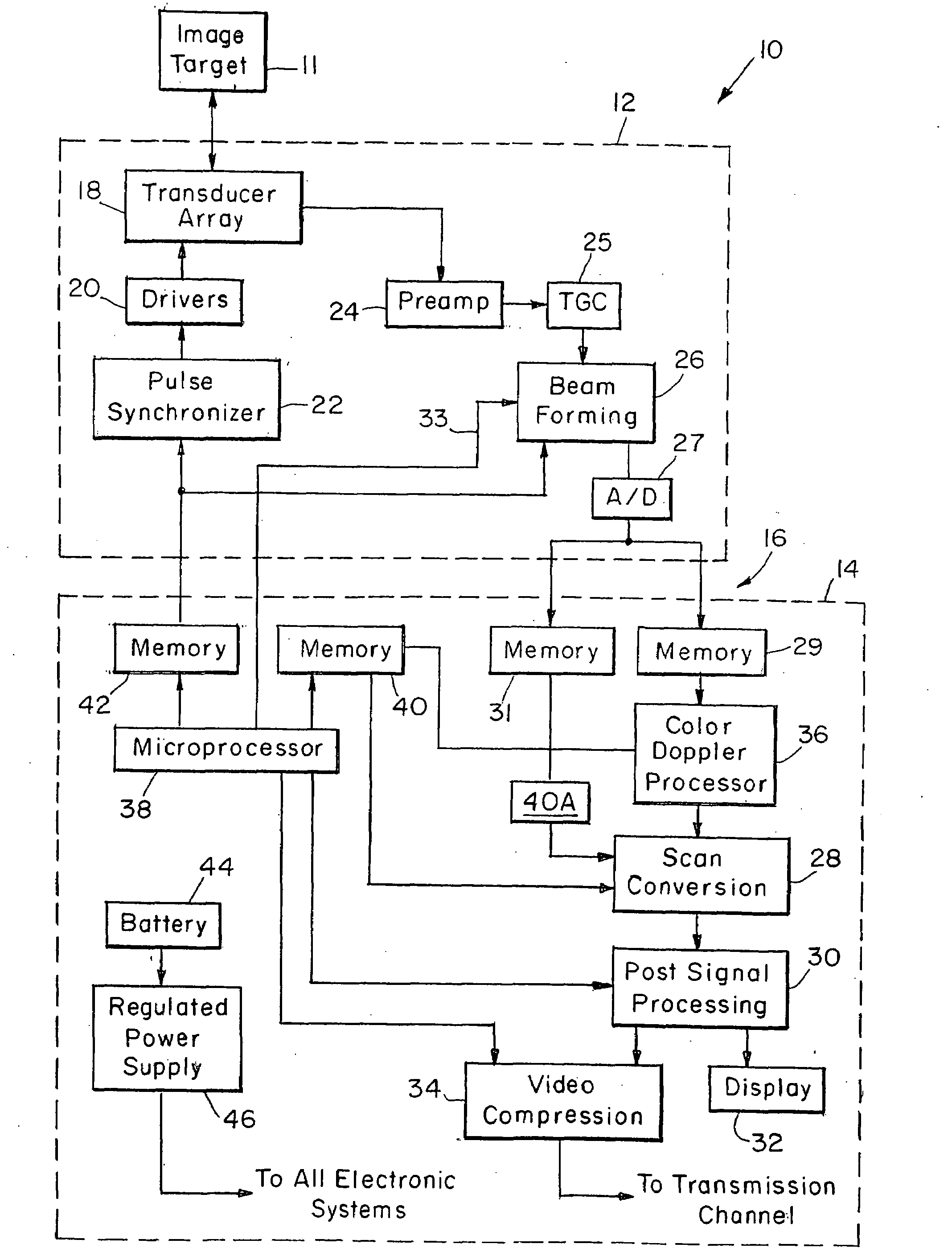 Portable ultrasound imaging system