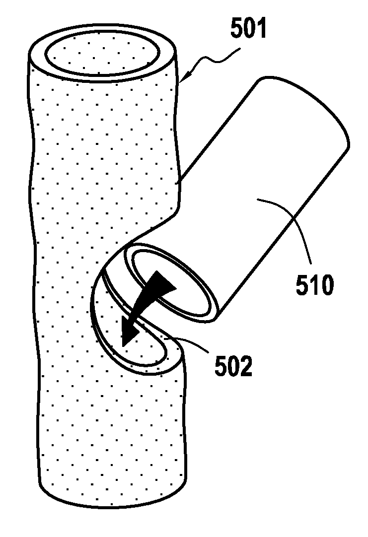 Prosthesis for promoting the in vivo reconstruction of a hollow organ or a portion of a hollow organ