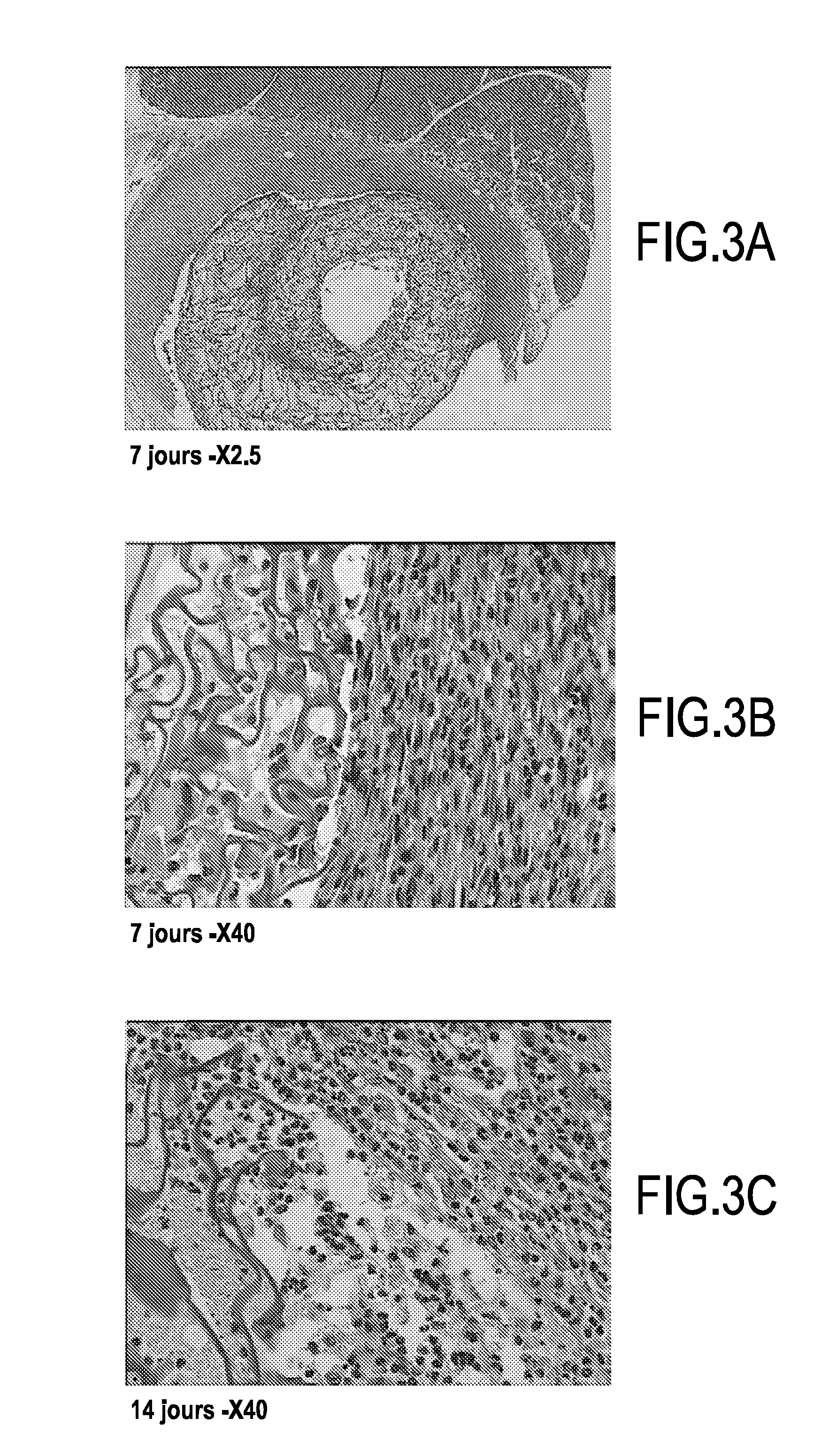 Prosthesis for promoting the in vivo reconstruction of a hollow organ or a portion of a hollow organ