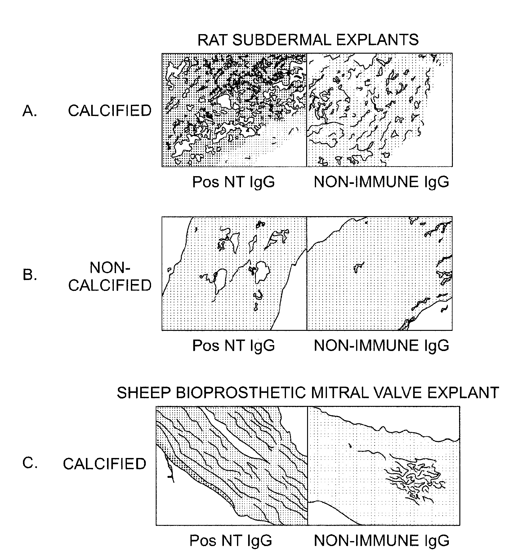 Oxidation resistant bioprosthetic tissues and preparation thereof