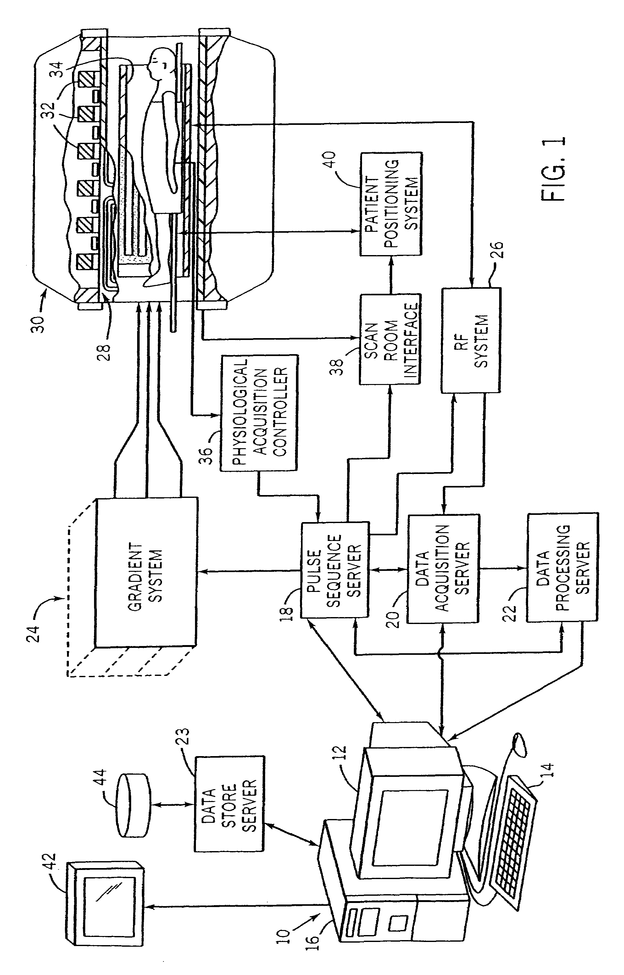 Accelerated shells trajectory MRI acquisition