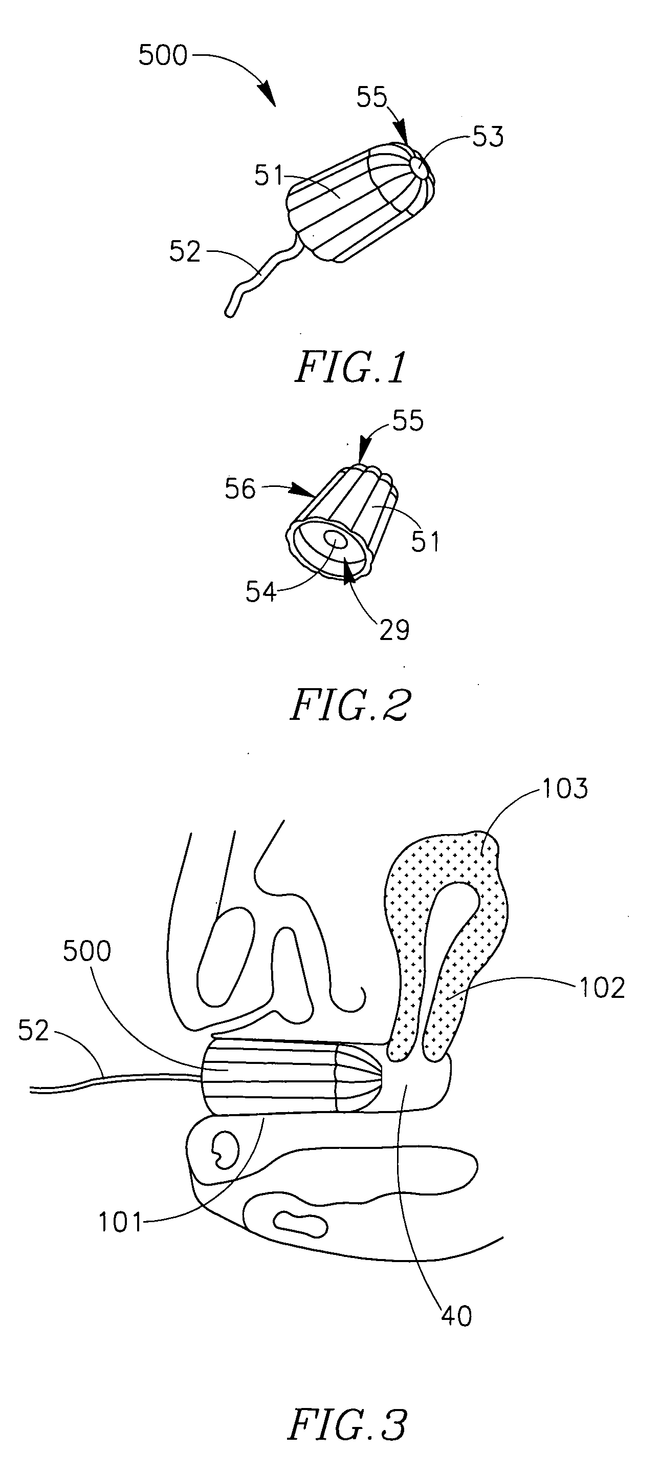 Devices, systems and methods for shortening menstrual period duration