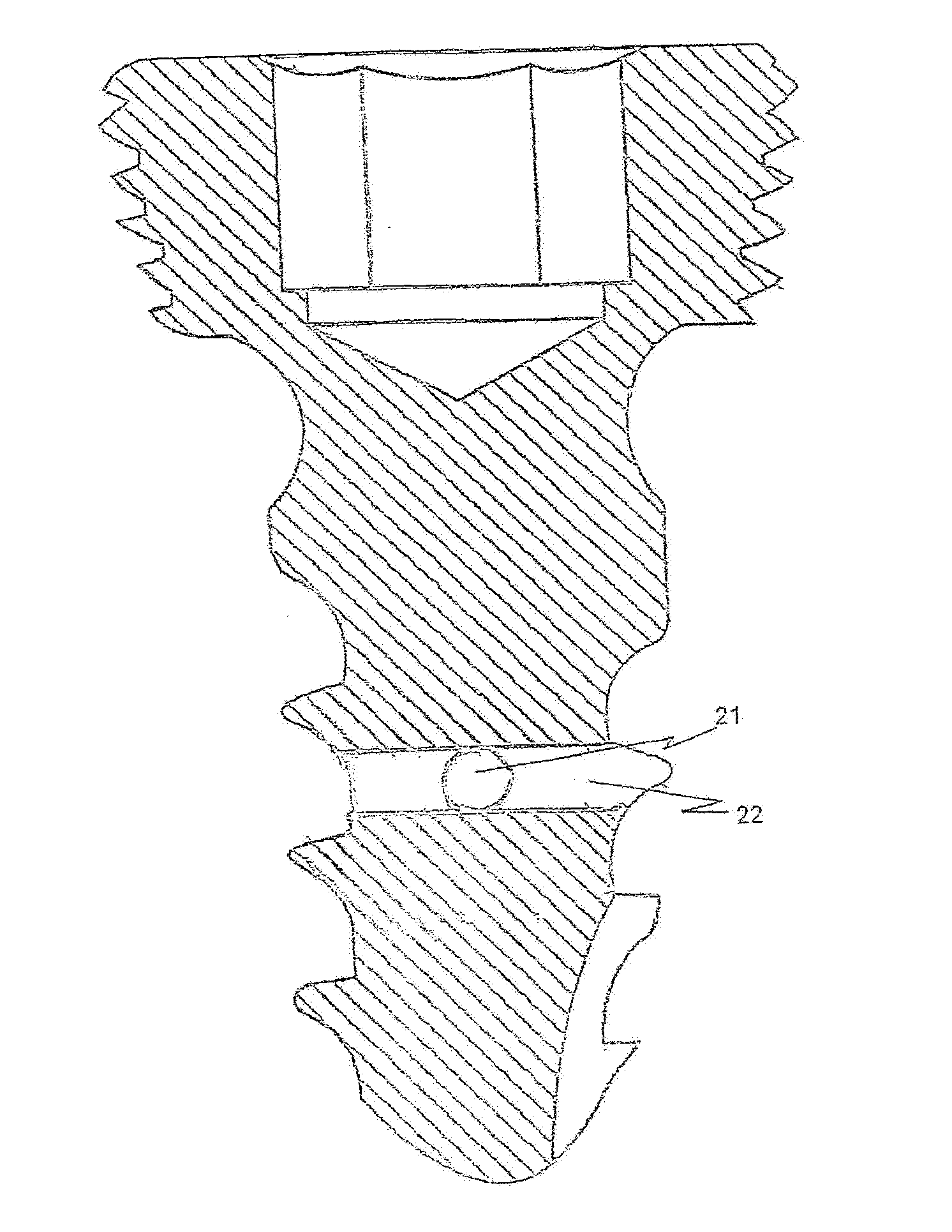 Bone fixation system with structure to enhance tissue growth and/or administer medicament inside bone