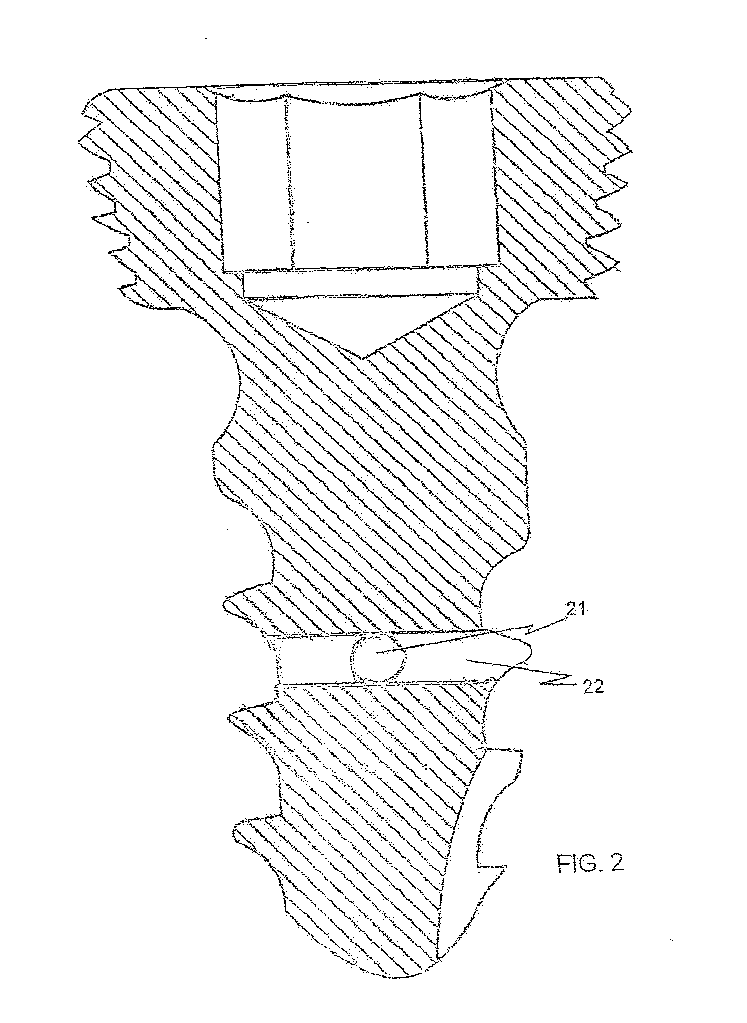 Bone fixation system with structure to enhance tissue growth and/or administer medicament inside bone