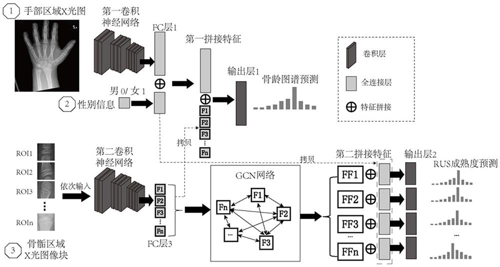 Double-bone-age evaluation method based on joint global and local convolutional neural network features