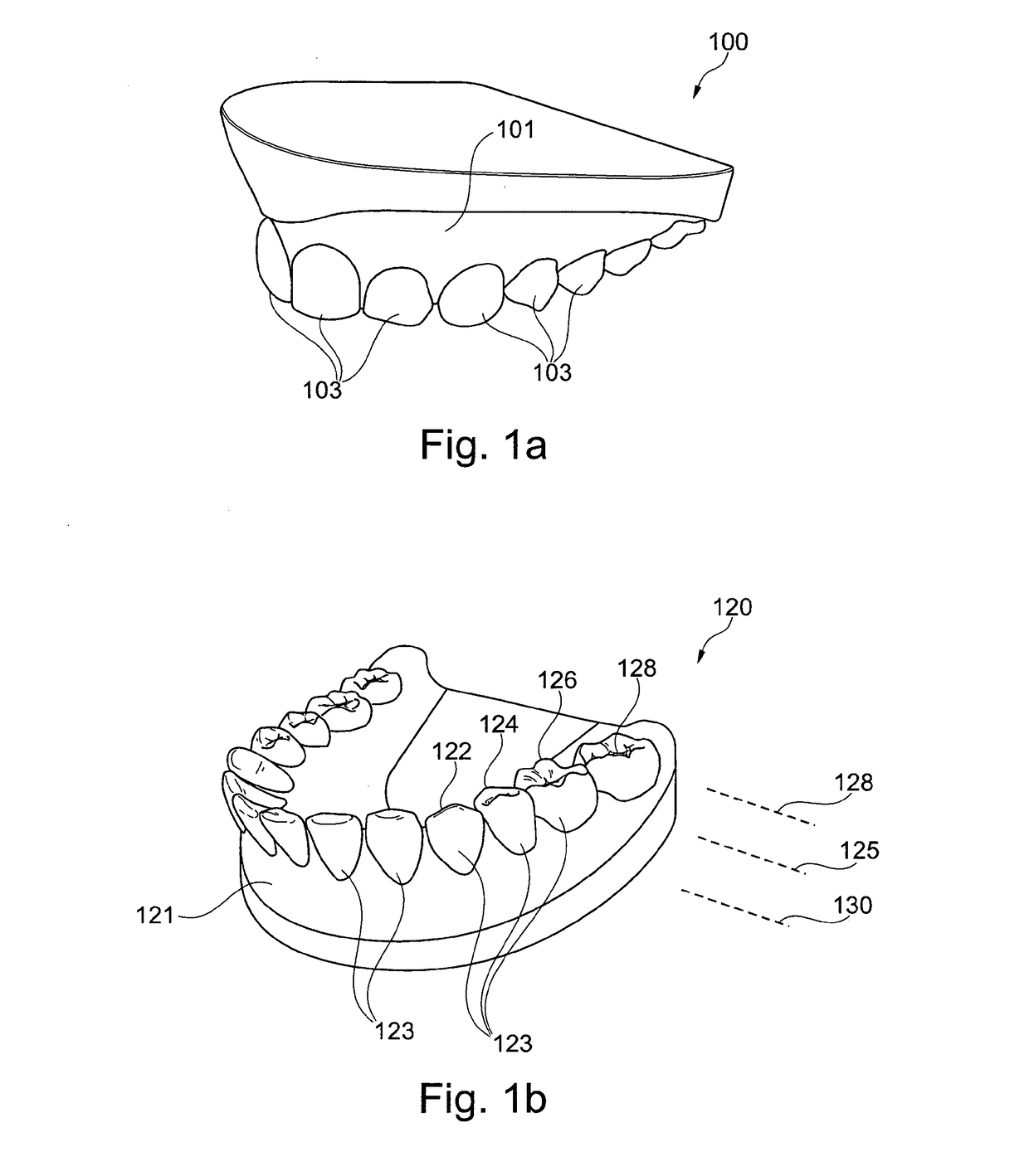 Dental auxiliary structure and manufacturing method