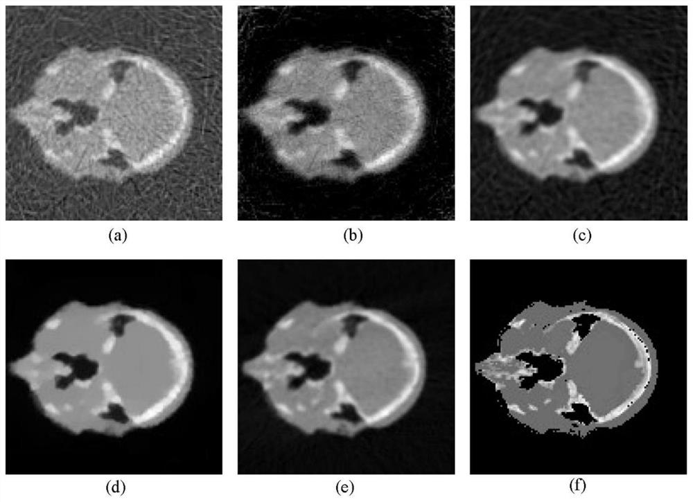Robust CBCT reconstruction method based on low-rank tensor decomposition and total variation regularization