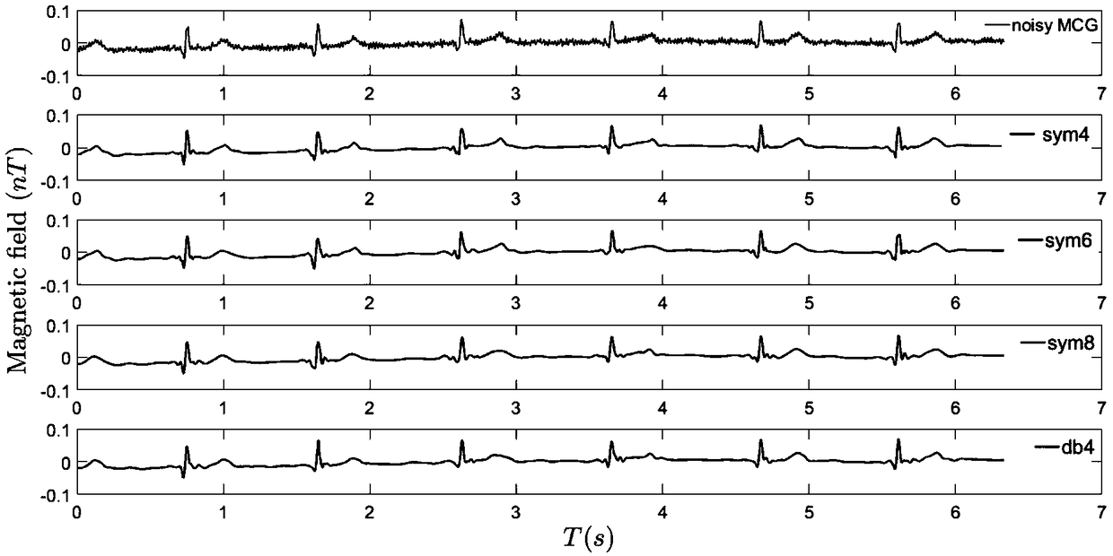 A denoising method of electrocardiogram signal based on wavelet transform
