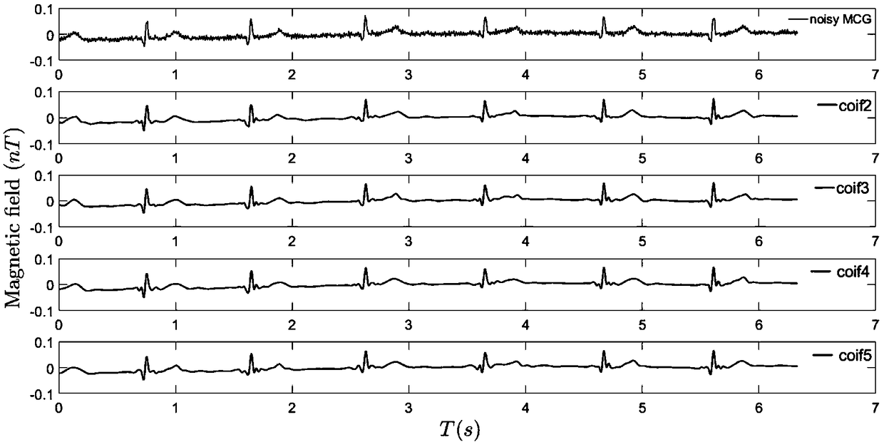 A denoising method of electrocardiogram signal based on wavelet transform