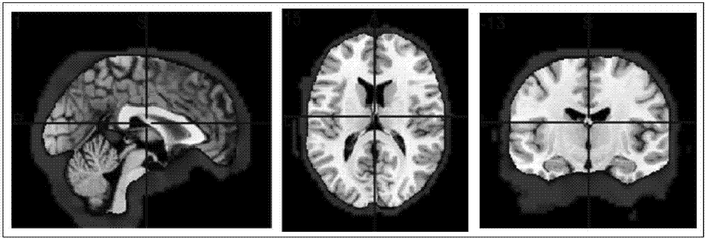 Cerebral functional magnetic resonance imaging blind source separation method based on grouping SIM algorithm