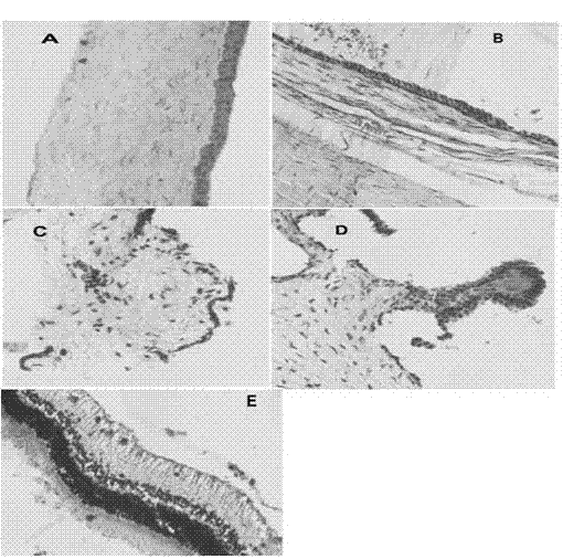 Gel for lysozyme eye and preparation method thereof