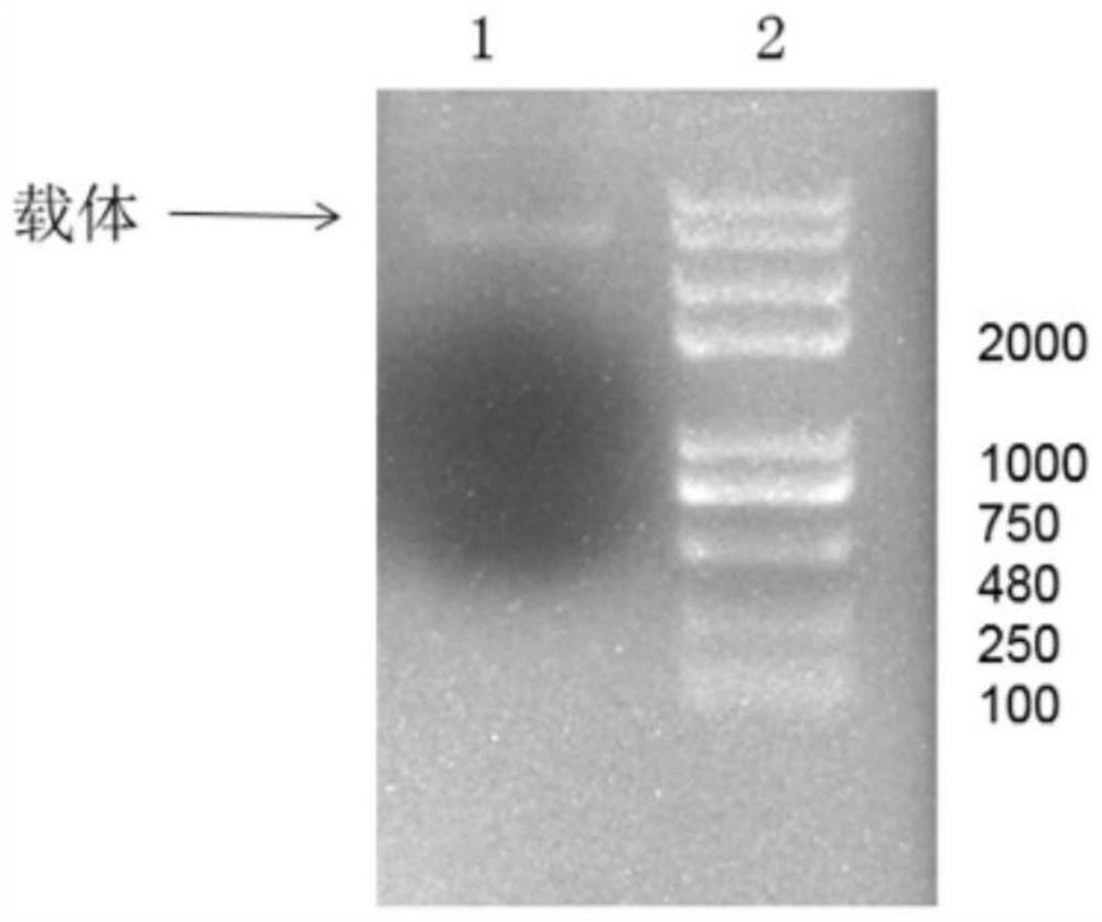 Recombinant plasmid containing HDAC1 gene promoter and reporter gene as well as construction and application of recombinant plasmid