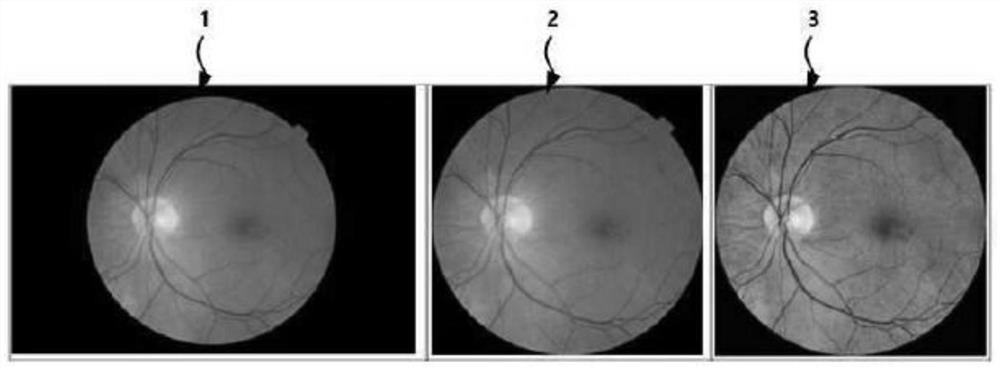 Eye disease diagnosis device and method based on deep neural network by using fundus image