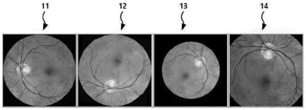 Eye disease diagnosis device and method based on deep neural network by using fundus image