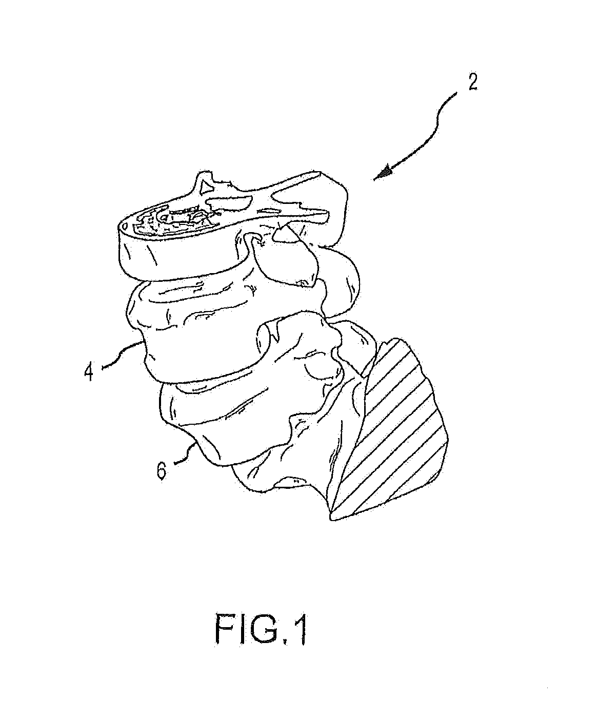 Patient-matched apparatus and methods for performing surgical procedures