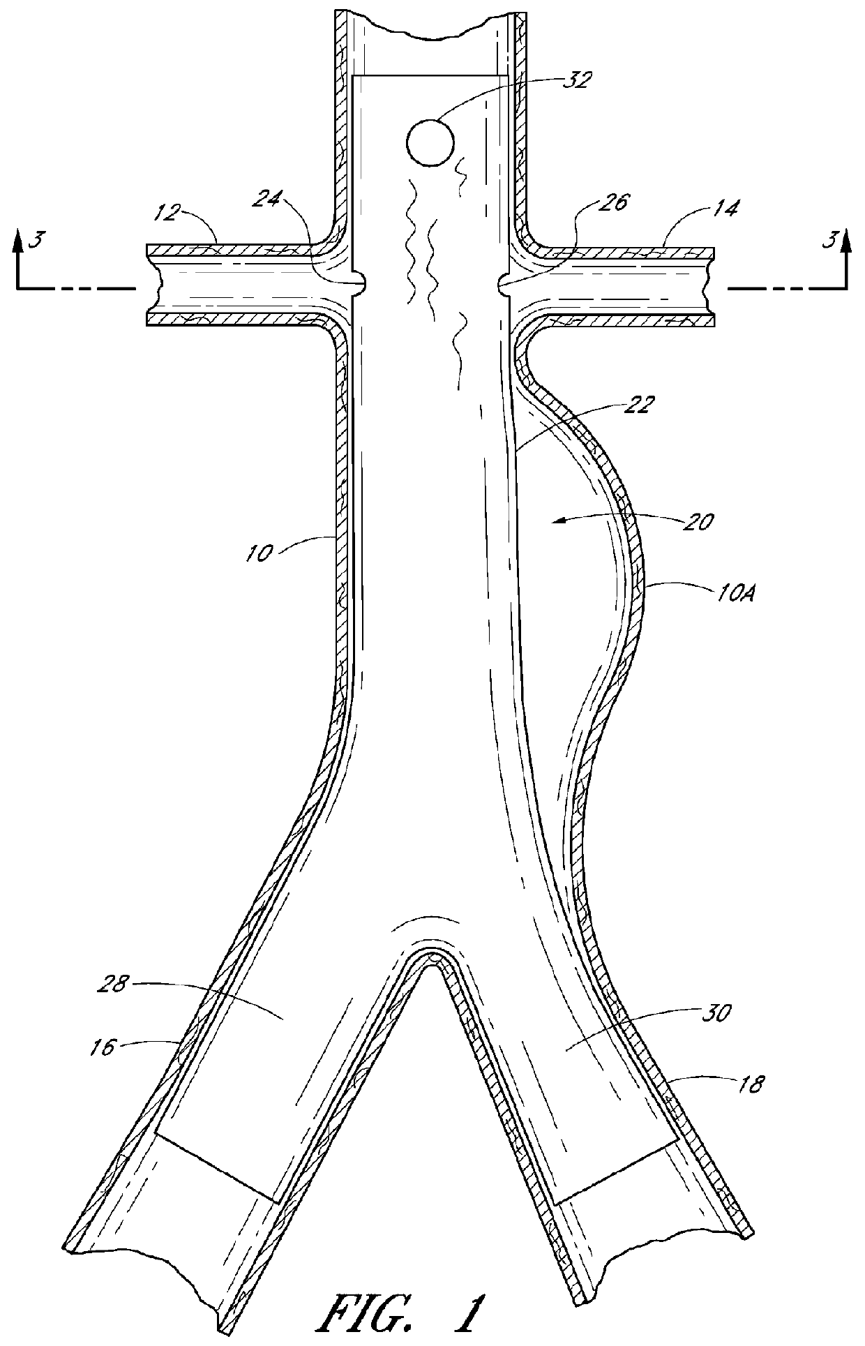 Apparatus and method of placement of a graft or graft system